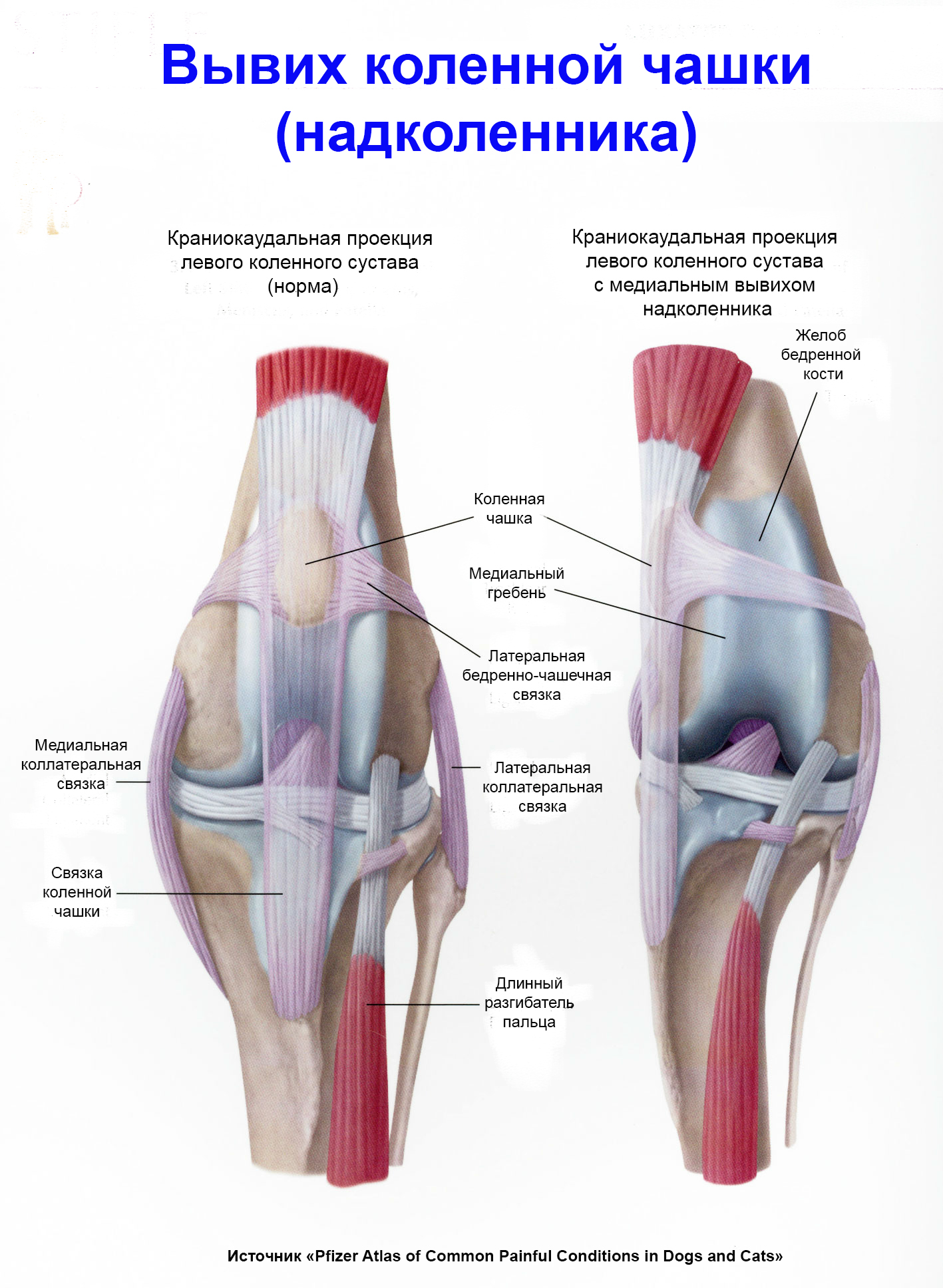 Вывих коленного сустава: симптомы, методы лечения и реабилитации